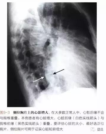 胸侧位正位片可以检查出什么,胸部正位侧片是测什么的