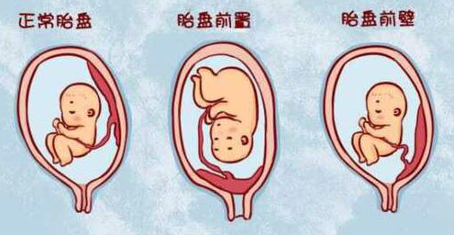 你了解孕期知识吗,你知道胎盘是怎么形成的不