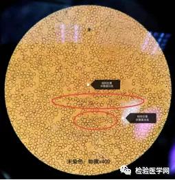 “秒”看血小板聚集，你get到了吗？