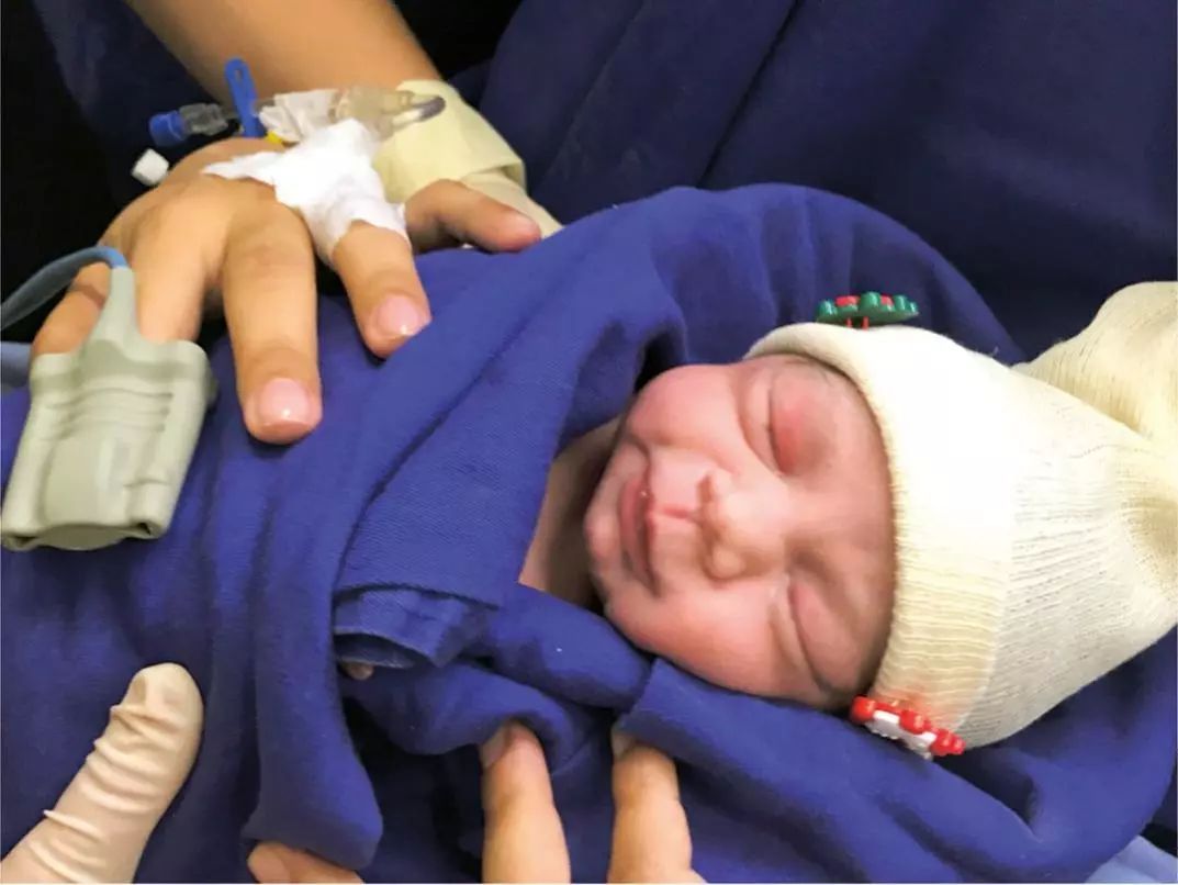 巴西女子用移植子宫成功产女！离男人生孩子还会远吗？