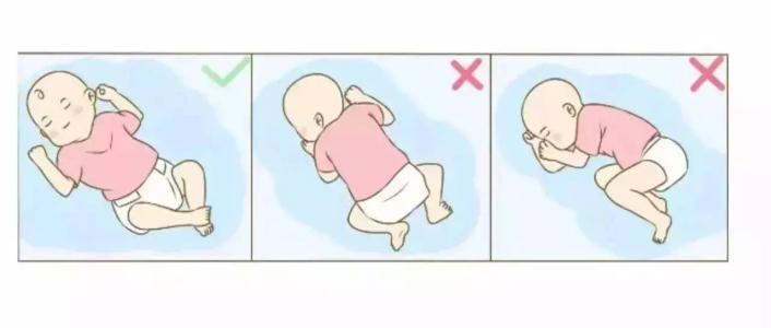 小孩是o型腿图片,孩子x型腿很严重应该怎么解决