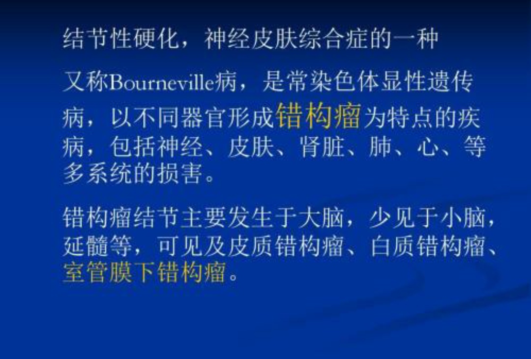 儿童结节性硬化症癫痫,遗传性癫痫伴有结节硬化能治愈吗
