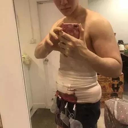 泰国网红花巨资整容30次,泰国网红花费百万整容