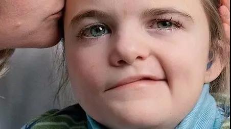 怎么拯救已经发过的面,怎么能拯救被毁了的头