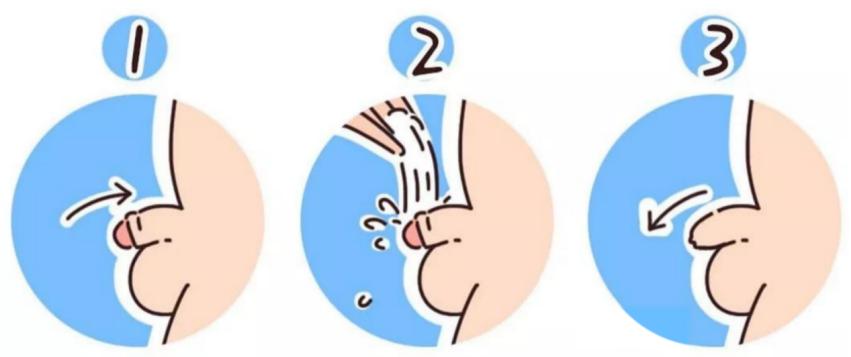 带孩子割包皮家长要准备什么,割包皮只有在暑假的时候才能割吗