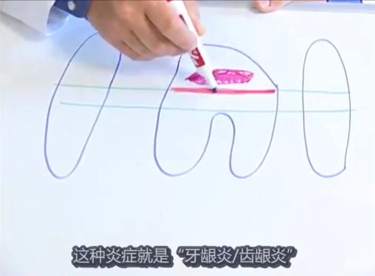 猫有牙结石牙龈红肿怎么治疗,猫已经有牙结石了怎么办