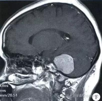 这些部位的黑色素瘤，您会诊断吗？