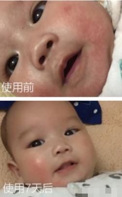 屈臣氏面霜推荐,林志颖面霜推荐