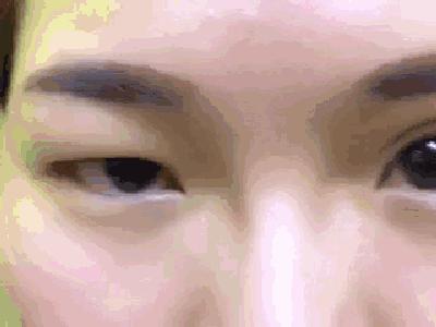 原来双眼皮不好看有必要继续割吗,双眼皮越看越奇怪怎么办