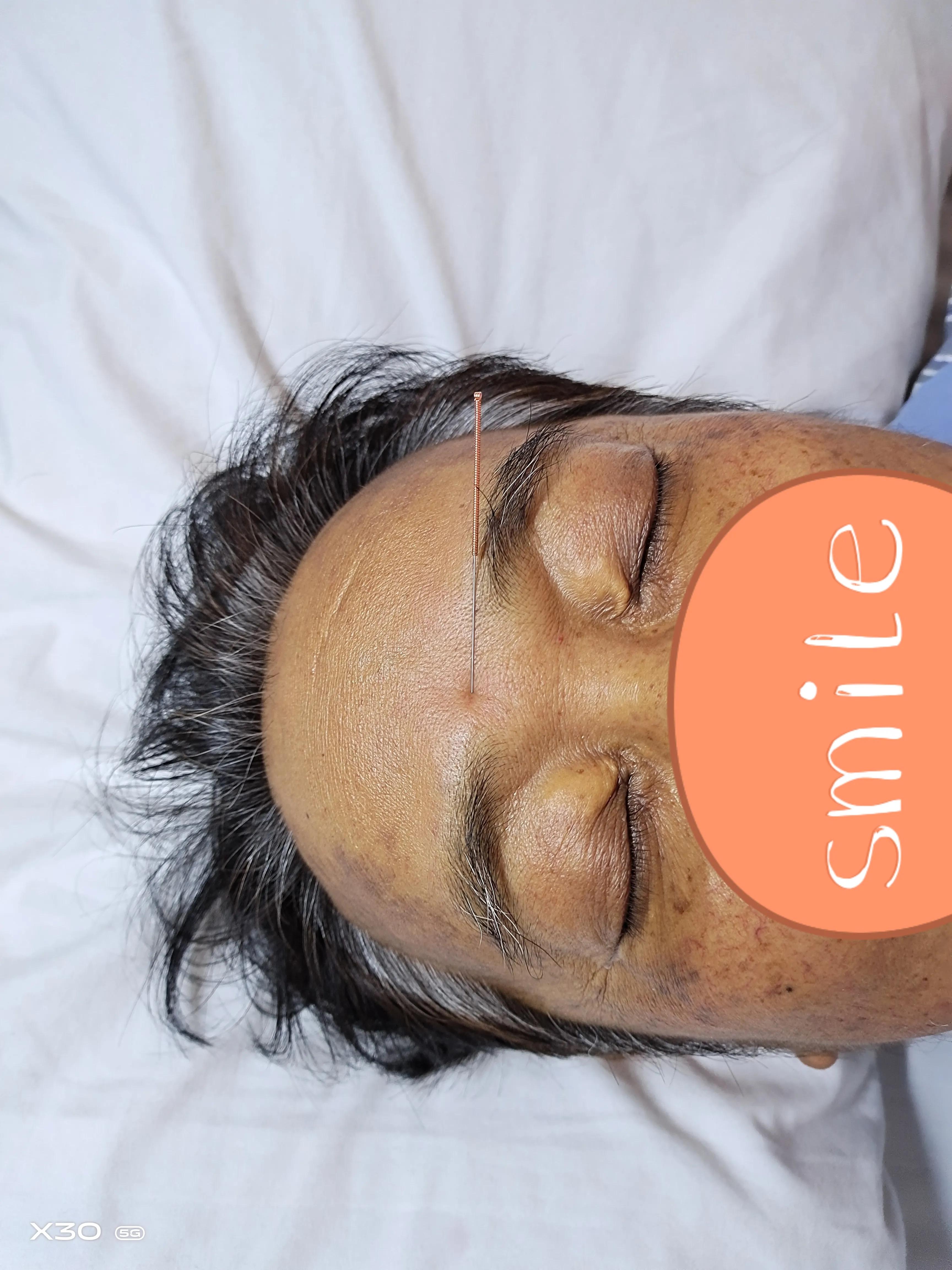 中医不是慢郎中,一招教你治打嗝