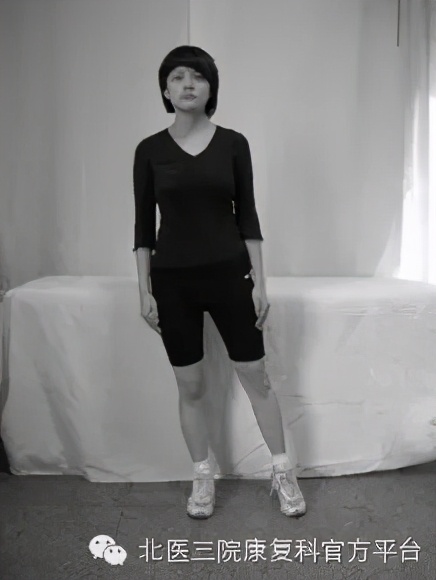 髋关节撞击综合征微创手术恢复,关节镜微创术半月板修复后康复