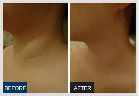 蜜梨六胜肽面霜李佳琦,日本蜜梨面霜李佳琦