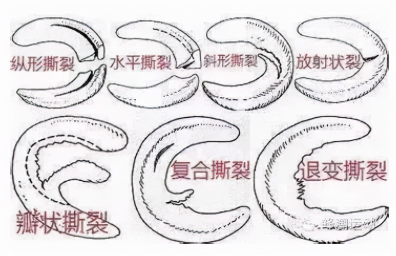 微创手术能治好骨性关节炎吗,膝盖关节镜微创手术要脱衣服吗