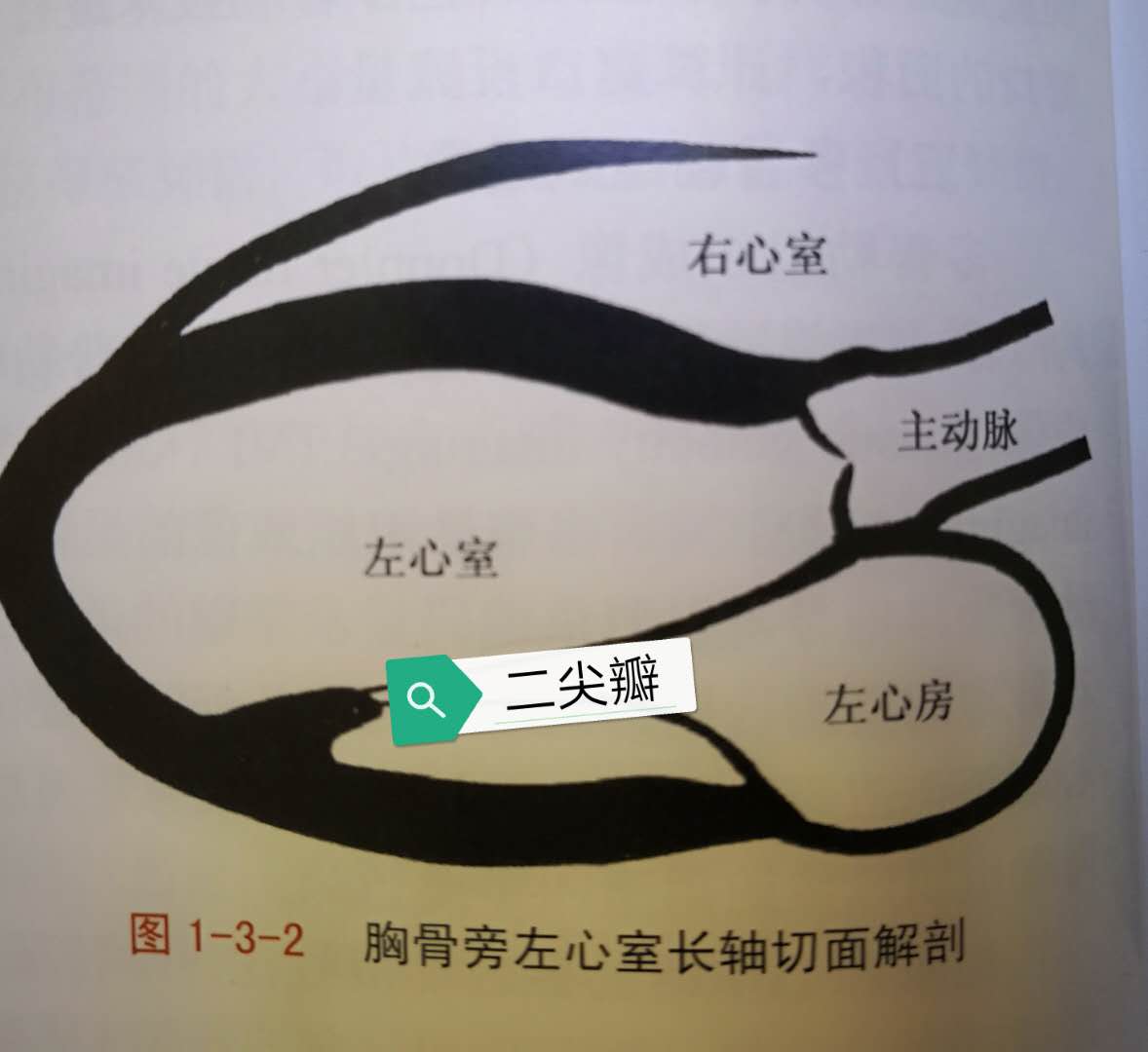 二尖瓣三尖瓣轻度返流是怎么回事,二尖瓣三尖瓣轻度返流怎么引起的