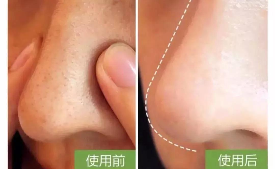 好皮肤怎么样养成的,好脸蛋