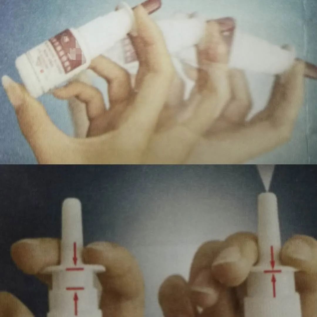 糠酸莫米松鼻喷雾剂使用多久,鼻喷雾剂喷上多久能通