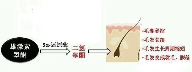 治疗脱发不脱发的办法,一招解决你的脱发秃顶