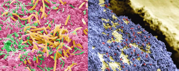 牙齿全部变黑的原因及治疗方法,牙齿变黑怎么办什么原因导致的