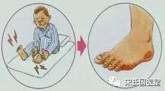 糖尿病与皮肤有什么关系,什么样的皮肤病一直反反复复