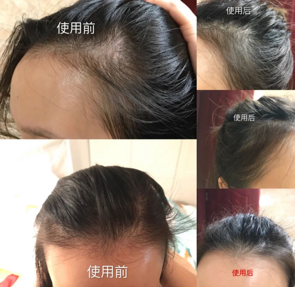 中国口碑最好的洗发水无硅油,洗发水推荐平价学生30元左右