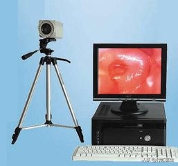 孕期tct轻度炎症怎么办,孕期tct检查是什么意思