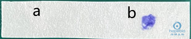 霍乱弧菌分型鉴定,霍乱弧菌的鉴定方法有几种