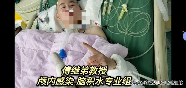 晚期鲍曼不动杆菌化脓性颅内感染的治疗