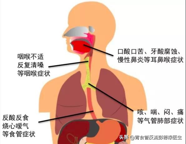 清嗓子声音嘶哑吞咽疼,喉咙有异物感做胃镜看得出来吗