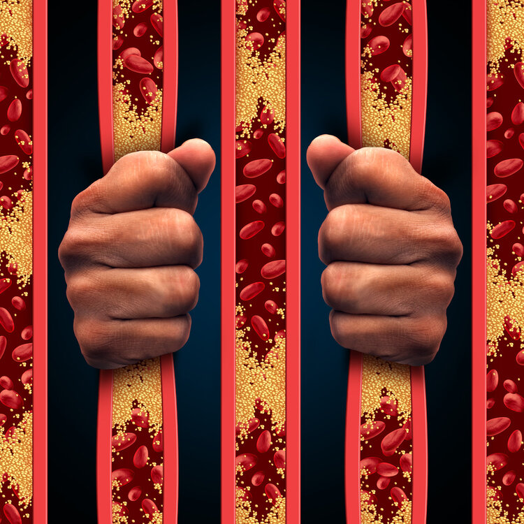 冠心病、高血压、高血脂之间也玩“俄罗斯套娃”？