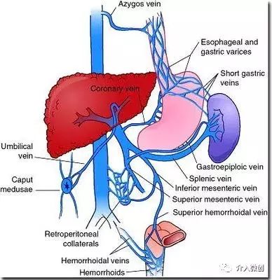 门静脉高压介入治疗好吗,缓解门静脉高压微创手术