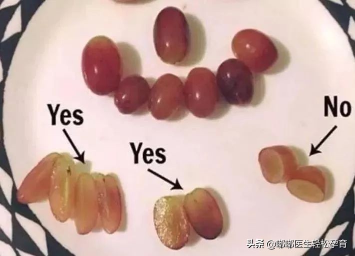 易使儿童窒息的十种食物,孩子因食物而死