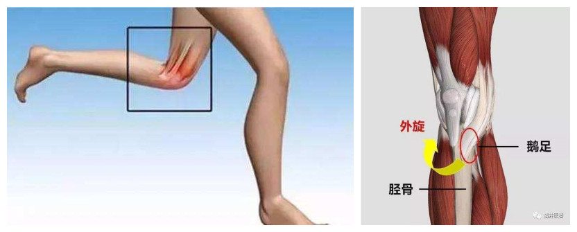 鹅足炎的理疗方法,鹅足炎不治能好吗