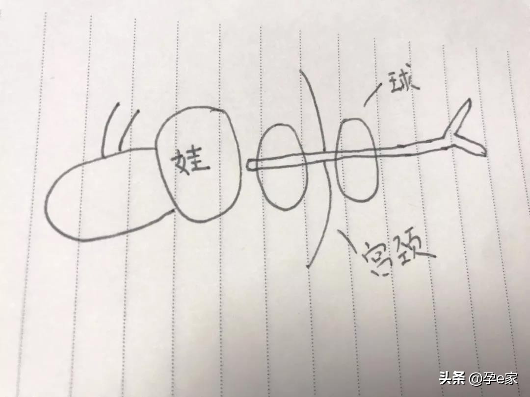 37周胎盘成熟度一级可以生么,孕37周胎盘没有成熟是好是坏