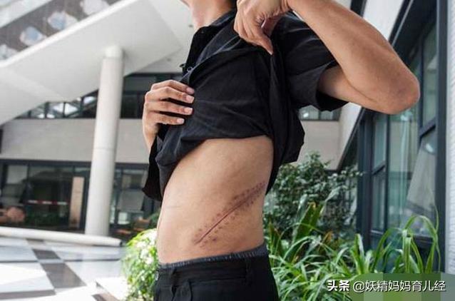 8年前卖肾换苹果手机,曾经卖肾换苹果手机的人怎么样了