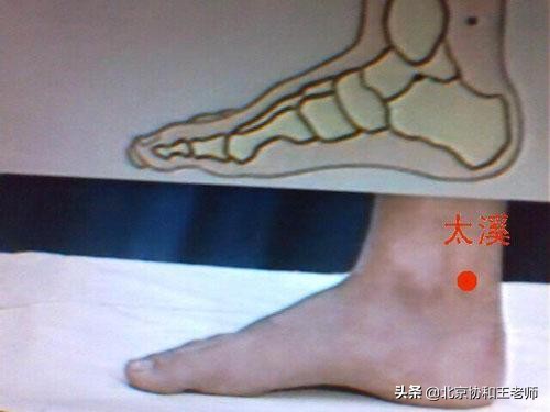 肾阴虚穴位,董氏奇穴治疗肾阳虚的穴位