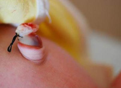 宝宝肚脐突然渗血多怎么回事,新生儿脐带脱落后肚脐出血的护理