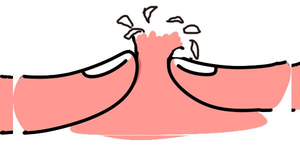 长期戴口罩皮肤爆痘过敏怎么办,戴口罩闷痘怎么办用什么药