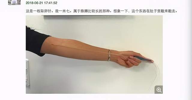 一颗卵子值100,卵子捐卵