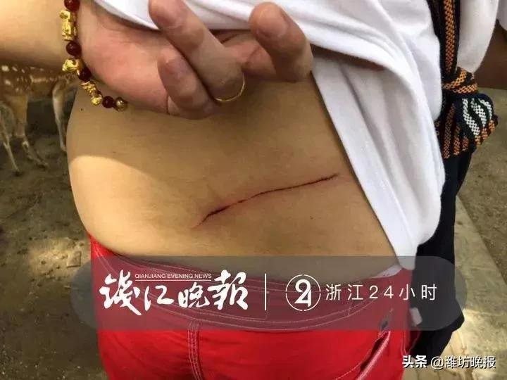 奈良被鹿咬了用打针吗,奈良喂小鹿被吓哭