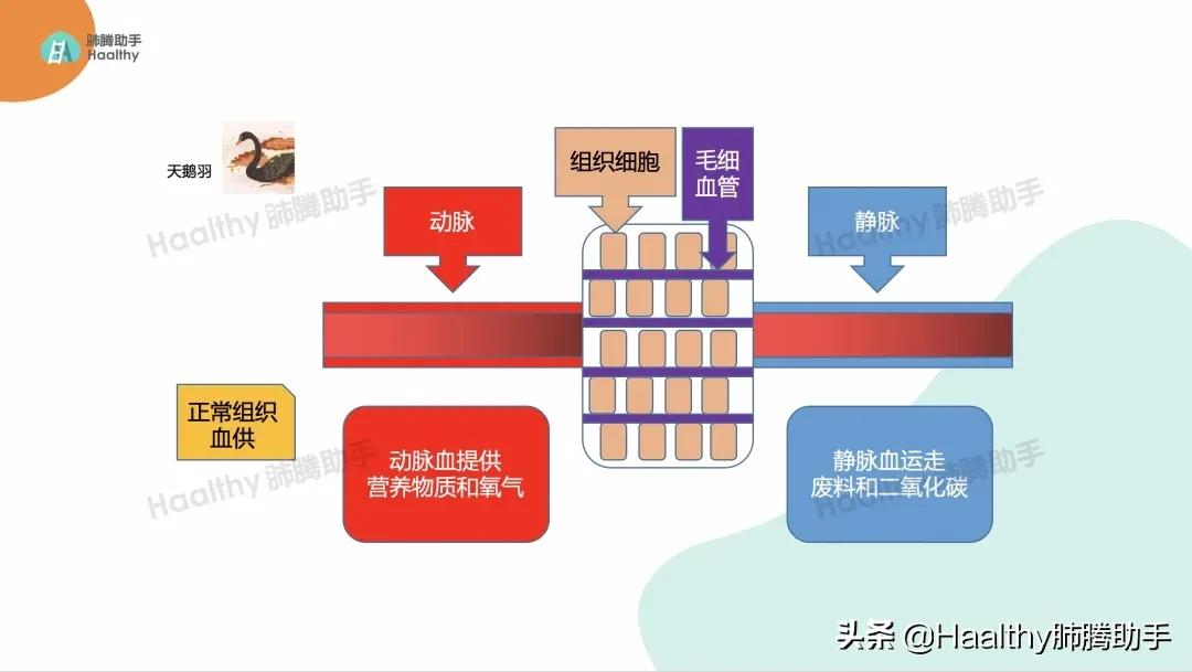 肺癌伴有骨转移最好的治疗办法,肺癌靶向治疗后骨转移怎么办