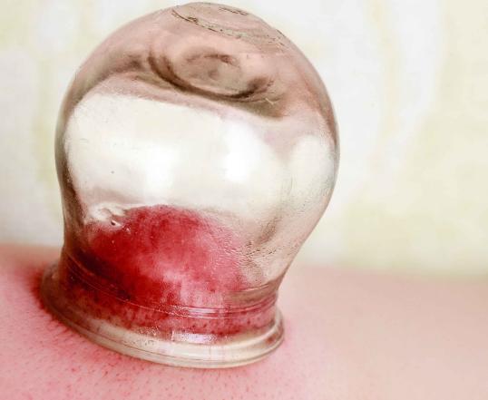 口腔溃疡反反复复怎样治好得快,倪海厦寒湿口腔溃疡最快解决方法