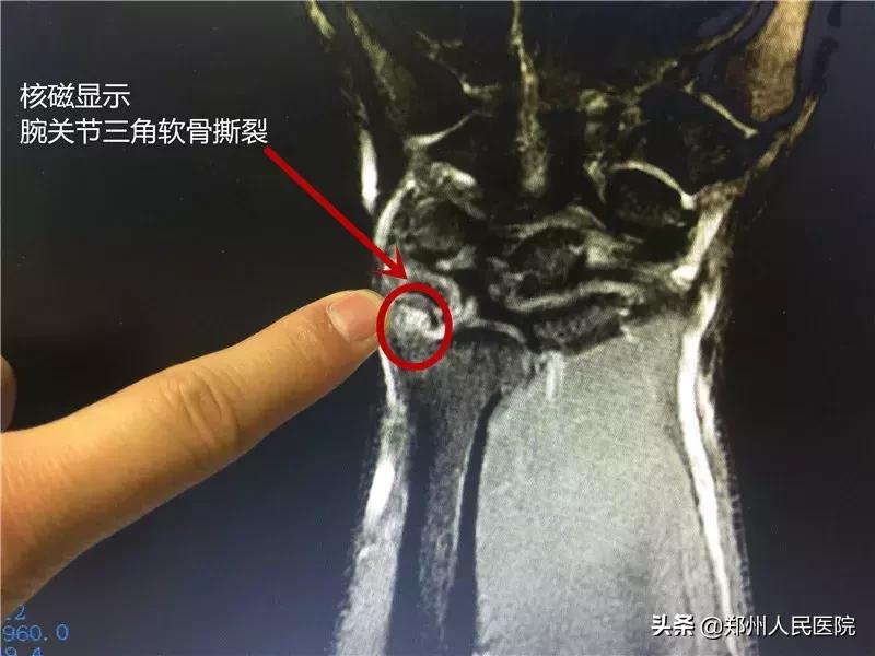 手腕疼10年了怎样治疗,20岁小伙手腕关节疼痛是怎么回事