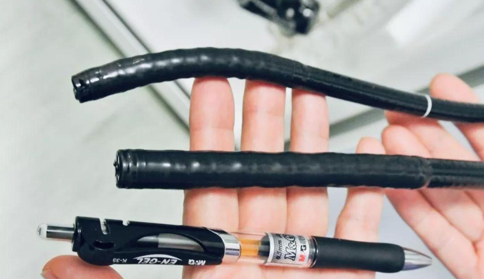 消化内镜和无痛胃镜的区别,想知道普通胃镜到底有多痛苦