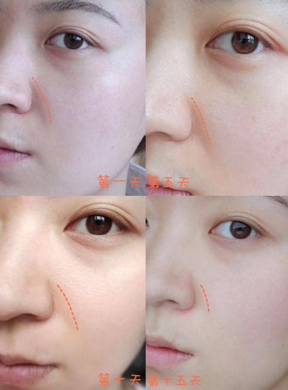 陈乔恩金箔面膜,陈乔恩皮肤真好