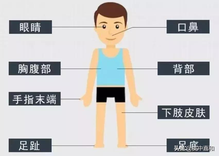 怎么区分黑痣与黑色素瘤,怎么区分黑色素瘤和痦子