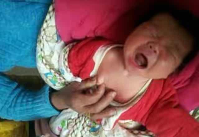 19岁女生没长出乳头，因出生时听信老人言，很多宝宝都被这样对待