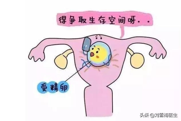 什么是子宫有什么用,子宫内膜与怀孕有什么关系