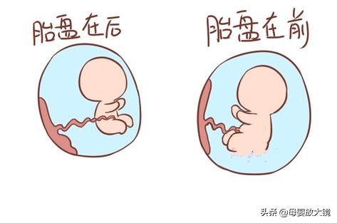 如何排除孕早期用药对胎儿的影响,孕早期有哪些症状需要及时就医