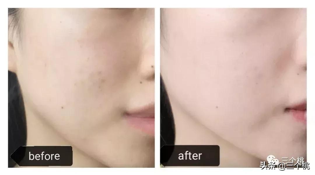 十大公认好用的粉底液评测,十大口碑最好的粉底液夏天