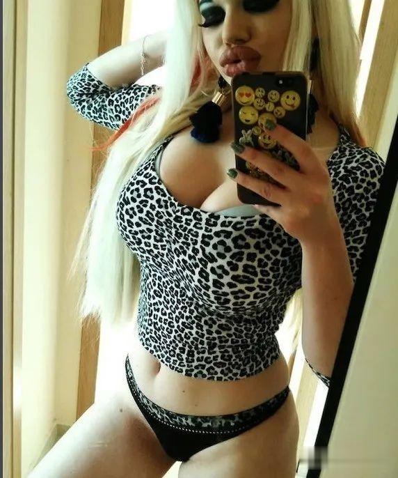 20次整容成功的女人,22岁女人做20次丰唇手术